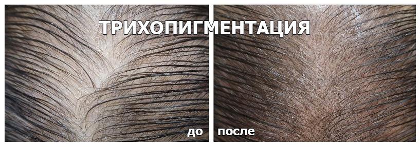 Трихопигментация до и после у женщин